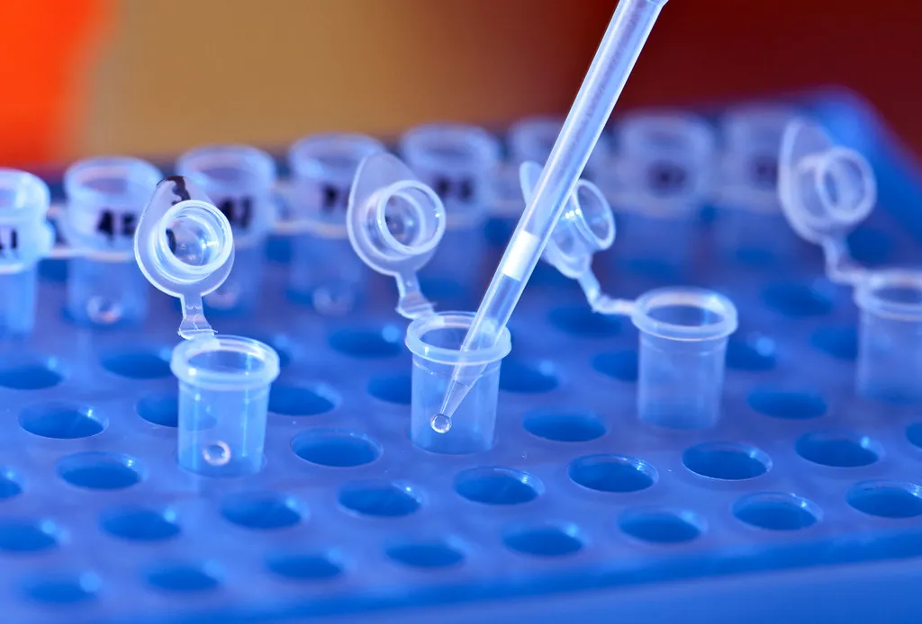 Pipeta y tubos de muestra en un rack de laboratorio (fotografía ilustrativa)